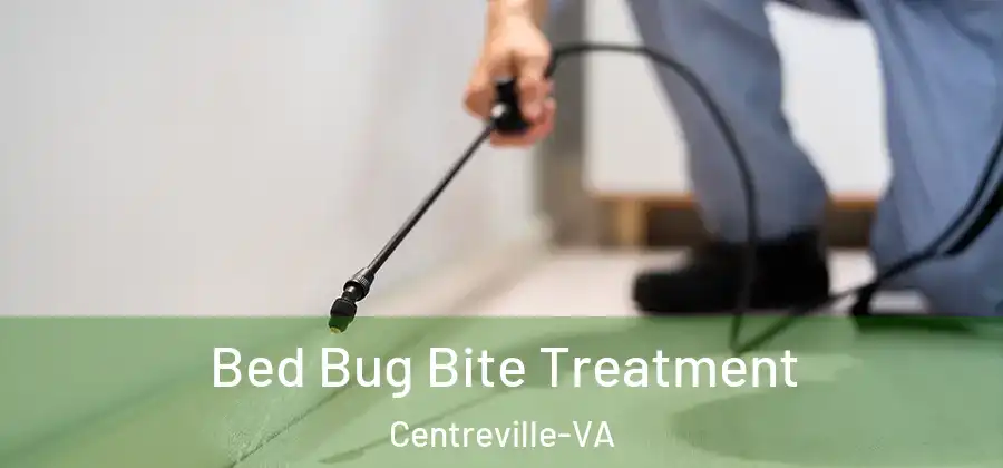  Bed Bug Bite Treatment Centreville-VA